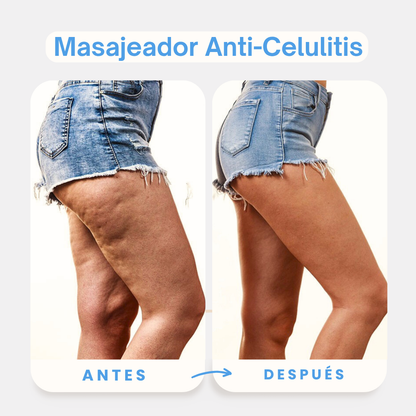 Masajeador Anti Celulitis + Masajeador Facial 3 en 1